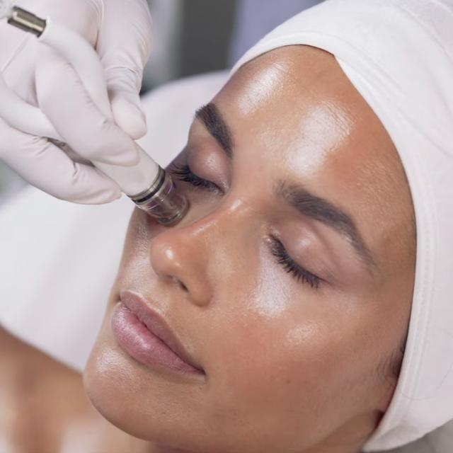 DIAMONDGLOW TREATMENT (6)